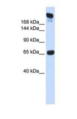 Western Blot: SI Sucrase-Isomaltase Antibody [NBP1-69357]