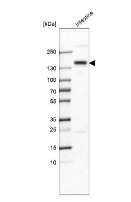 Western Blot: SI Sucrase-Isomaltase Antibody [NBP1-87581]