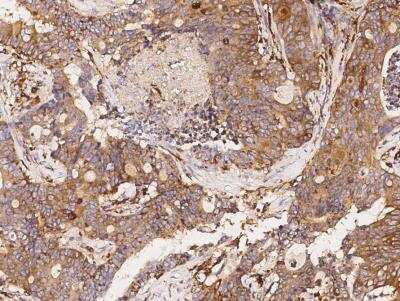 Immunohistochemistry-Paraffin: SIAE Antibody (03) [NBP3-06150]