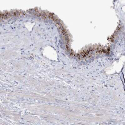 Immunohistochemistry-Paraffin: SIAE Antibody [NBP1-84372]