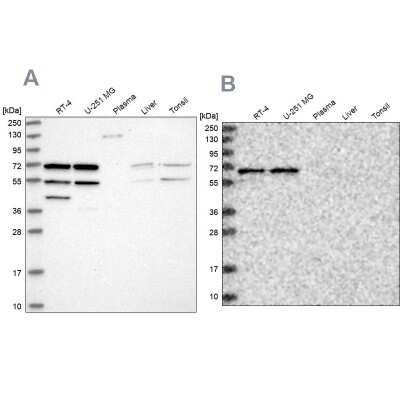 Western Blot: SIAE Antibody [NBP1-84371]