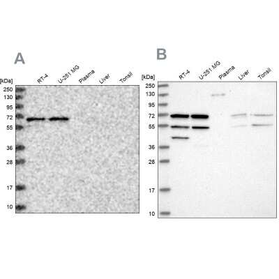 Western Blot: SIAE Antibody [NBP1-84372]