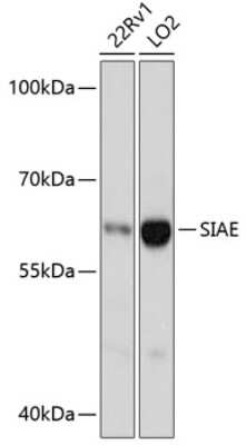 Western Blot: SIAE AntibodyAzide and BSA Free [NBP2-93817]