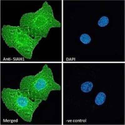 Immunocytochemistry/ Immunofluorescence: SIAH1 Antibody [NB300-974]