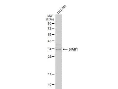 Western Blot: SIAH1 Antibody [NBP2-20356]