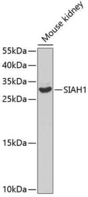 Western Blot: SIAH1 AntibodyAzide and BSA Free [NBP2-93864]