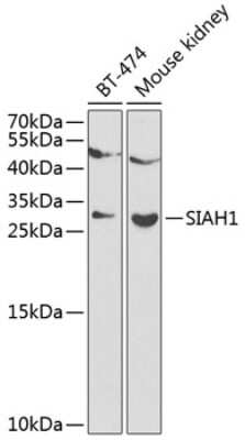 Western Blot: SIAH1 AntibodyBSA Free [NBP2-94122]