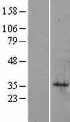 Western Blot: SIAH1 Overexpression Lysate [NBP2-04239]