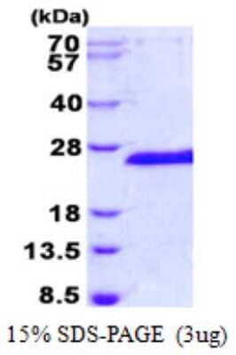 SDS-PAGE: Recombinant Human SIAH1 His Protein [NBP2-23470]