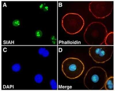 Immunocytochemistry/ Immunofluorescence: SIAH2 Antibody (24E6H3) [NB110-88113]