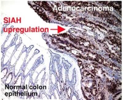 Immunohistochemistry: SIAH2 Antibody (24E6H3) [NB110-88113]