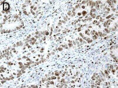 Immunohistochemistry: SIAH2 Antibody (24E6H3) [NB110-88113]