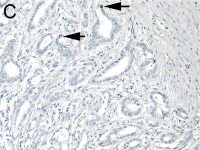 Immunohistochemistry: SIAH2 Antibody (24E6H3) [NB110-88113]