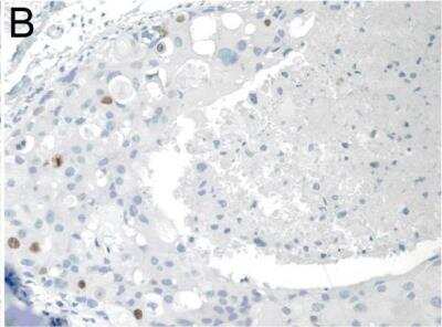Immunohistochemistry: SIAH2 Antibody (24E6H3) [NB110-88113]
