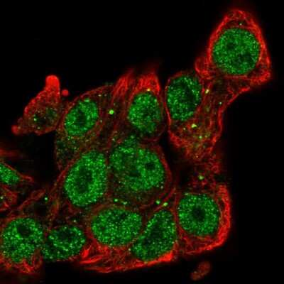 Immunocytochemistry/ Immunofluorescence: SIAH2 Antibody [NBP2-56198]