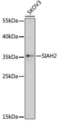 Western Blot: SIAH2 AntibodyAzide and BSA Free [NBP2-93257]