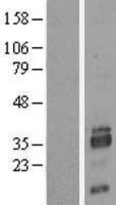 Western Blot: SIAH2 Overexpression Lysate [NBL1-15955]