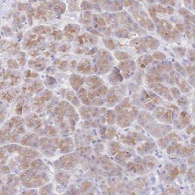 Immunohistochemistry-Paraffin: SIAH3 Antibody [NBP2-32555]