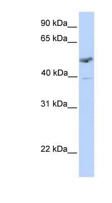 Western Blot: ST3 beta-Gal alpha-2,3-Sialyltransferase 1/ST3GAL1/SIAT4A Antibody [NBP1-62540]