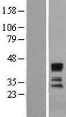 Western Blot: ST3 beta-Gal alpha-2,3-Sialyltransferase 1/ST3GAL1/SIAT4A Overexpression Lysate [NBL1-16490]