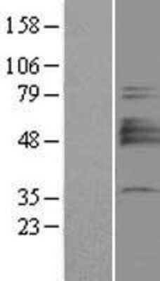 Western Blot: ST3 beta-Gal alpha-2,3-Sialyltransferase 1/ST3GAL1/SIAT4A Overexpression Lysate [NBP2-04433]
