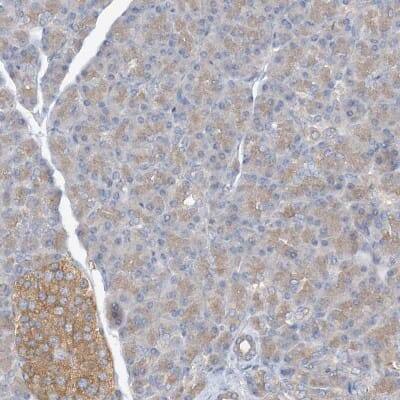 Immunohistochemistry-Paraffin: SIDT1 Antibody [NBP1-82200]