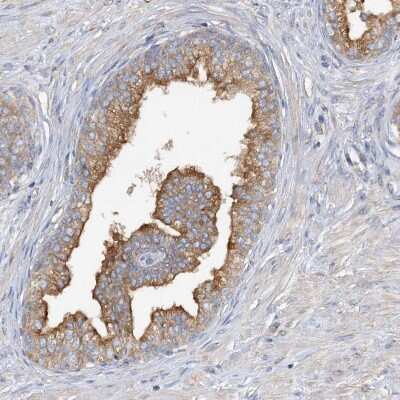 Immunohistochemistry-Paraffin: SIDT1 Antibody [NBP1-82200]