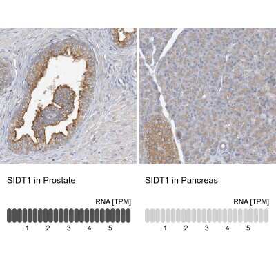 Immunohistochemistry-Paraffin: SIDT1 Antibody [NBP1-82200]