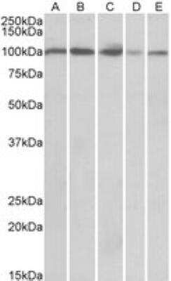 Western Blot: SIDT1 Antibody [NBP2-27547]