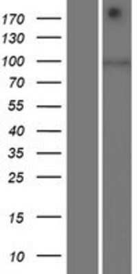 Western Blot: SIDT1 Overexpression Lysate [NBP2-06941]