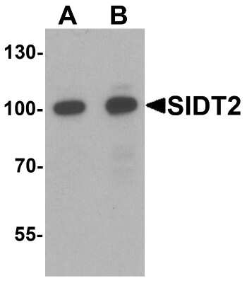 Western Blot: SIDT2 AntibodyBSA Free [NBP2-82009]