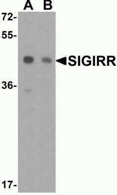 Western Blot: SIGIRR AntibodyBSA Free [NBP1-76599]