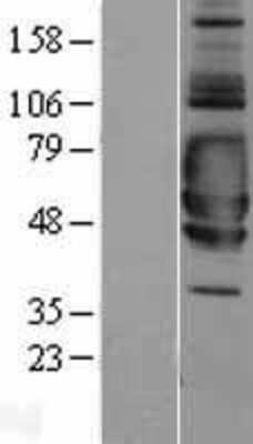 Western Blot: SIGIRR Overexpression Lysate [NBL1-15956]