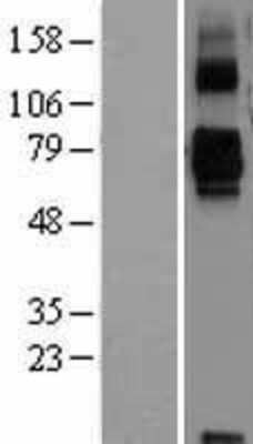 Western Blot: Siglec-11 Overexpression Lysate [NBL1-15958]