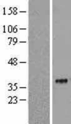 Western Blot: Siglec-15 Overexpression Lysate [NBL1-15959]