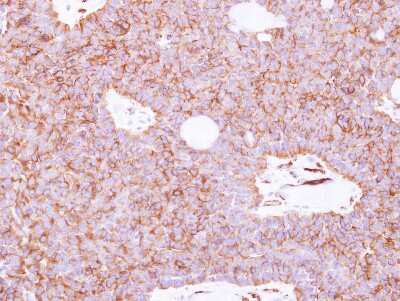 Immunohistochemistry-Paraffin: SIGLECL12 Antibody [NBP2-20362]