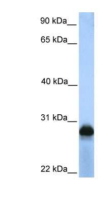 Western Blot: SIGLECL12 Antibody [NBP1-59242]