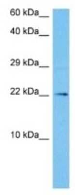 Western Blot: SIGNR2 Antibody [NBP3-10216]