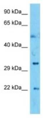 Western Blot: SIGNR3/CD209d Antibody [NBP3-10192]