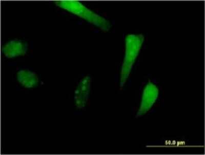 Immunocytochemistry/ Immunofluorescence: SIK1/Snf1lk Antibody (2C12) [H00150094-M01]