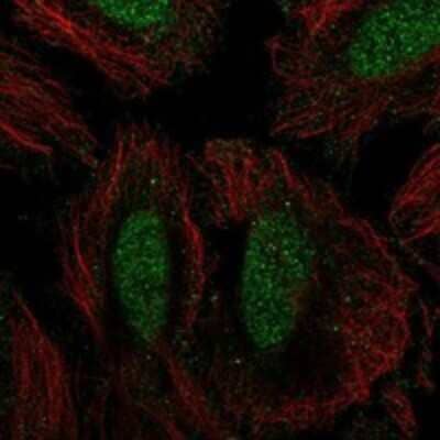 Immunocytochemistry/ Immunofluorescence: SIK1/Snf1lk Antibody [NBP3-17767]