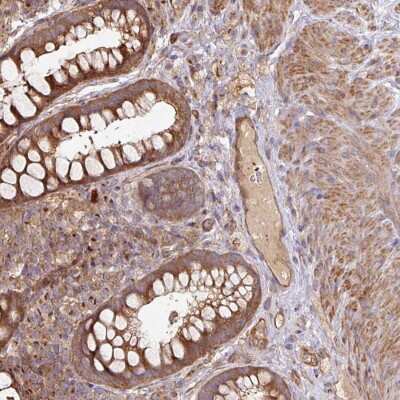 Immunohistochemistry: SIK1/Snf1lk Antibody [NBP2-38397]