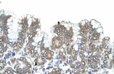 Immunohistochemistry-Paraffin: SIK1/Snf1lk Antibody [NBP1-53156]