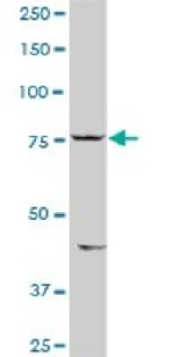 Western Blot: SIK1/Snf1lk Antibody [H00150094-D01P]