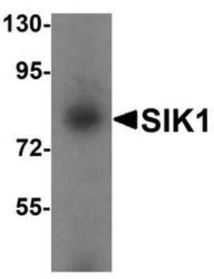 Western Blot: SIK1/Snf1lk AntibodyBSA Free [NBP1-76571]