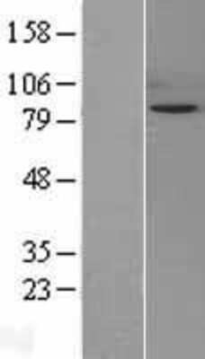 Western Blot: SIK1/Snf1lk Overexpression Lysate [NBL1-16278]