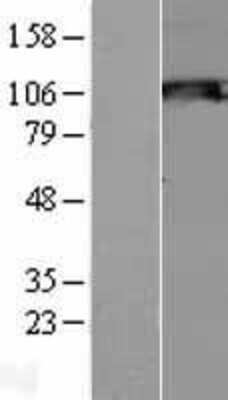 Western Blot: SNF1LK2/SIK2 Overexpression Lysate [NBL1-16279]