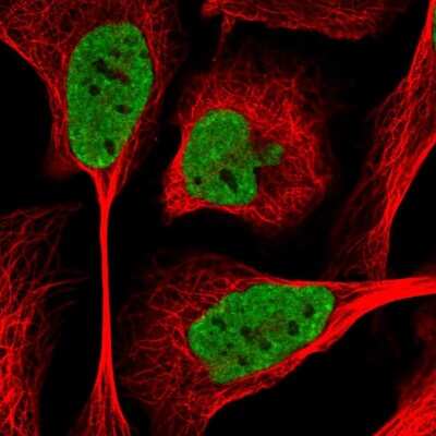 Immunocytochemistry/ Immunofluorescence: SIK3 Antibody [NBP2-47277]