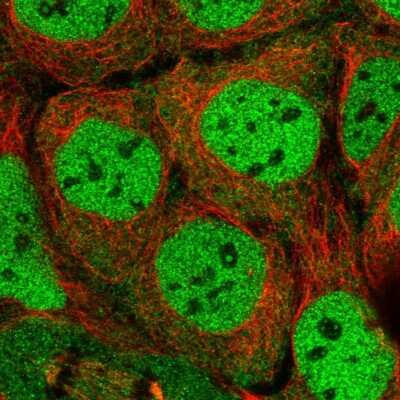 Immunocytochemistry/ Immunofluorescence: SIK3 Antibody [NBP2-47278]