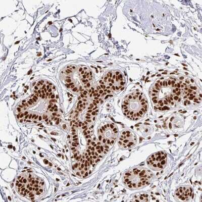 Immunohistochemistry-Paraffin: SIK3 Antibody [NBP2-47277]